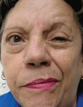 Questão 1
