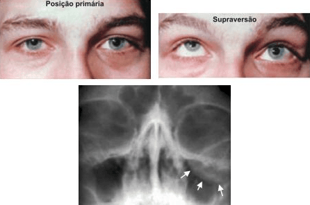 Questão 1