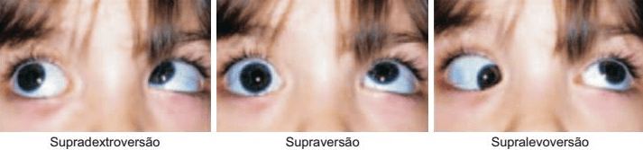 Questão 1