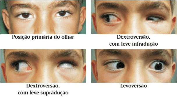 Questão 1
