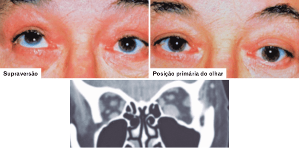 Questão 1