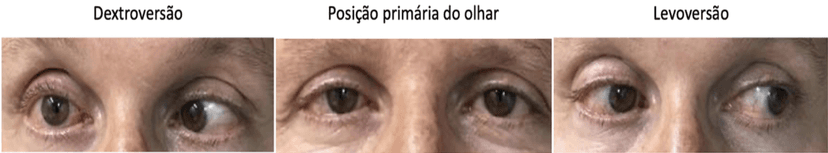 Questão 1